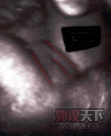 20140605035141785.jpg