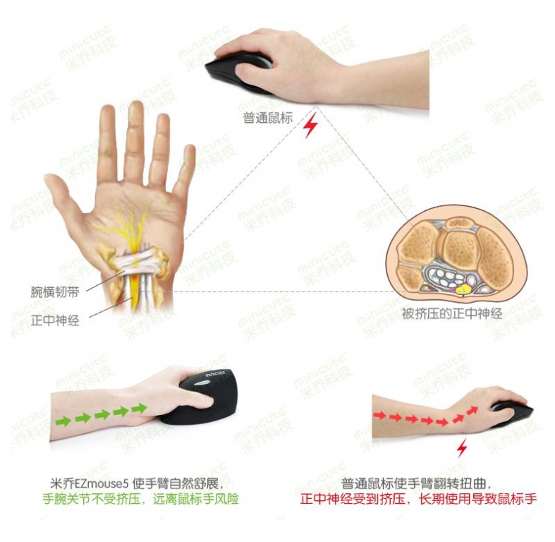 让右手歇一会！ minicute米乔人体工学EZmouse2左手激光版试用活动（试用名单已更新）