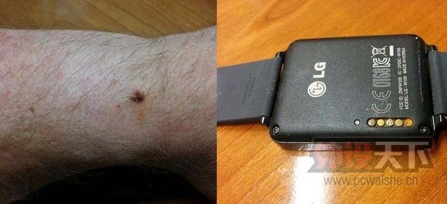 LGֱ紥ʴ ٷ